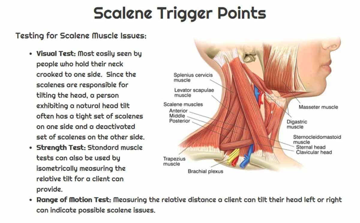 Scalene Exercises Stretches and Trigger Points